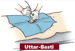 Uttar basti an Ayurvedic treatment, can also help with prostate enlargement