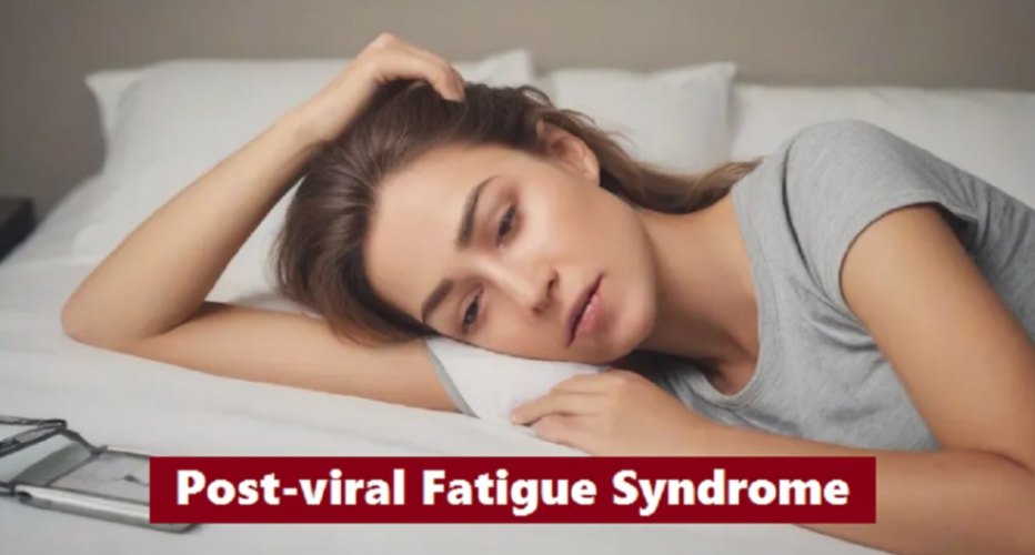 Post-Viral Fatigue Syndrome